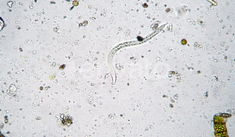 Nematode u vodi: Rizici i uklanjanje